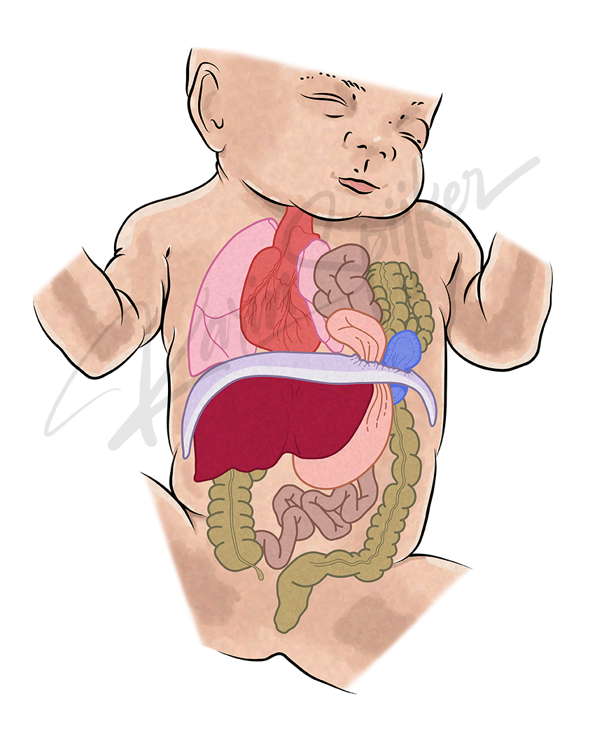 Understanding Anatomy in Congenital Diaphragmatic Hernia Diaphragm anatomy illustration for congenital diaphragmatic hernia (CDH) understanding.