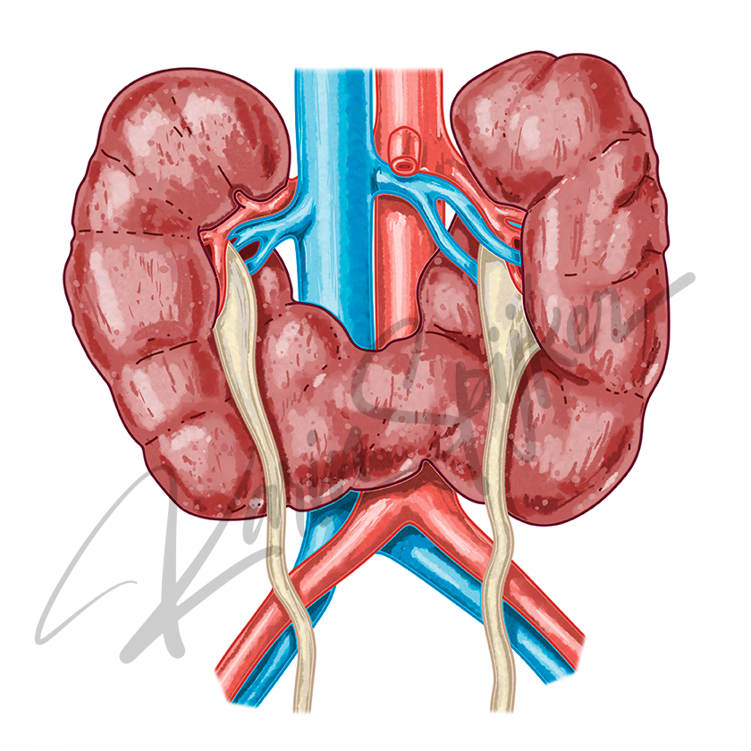 Understanding Trisomy 18 and Horse Shoe Kidneys Trisomy 18 (Edwards Syndrome) with horse shoe kidneys, depicting medical challenges and diagnosis.