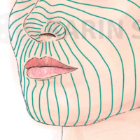 Detailed facial mapping illustration for RSTL analysis and aesthetic profiling.