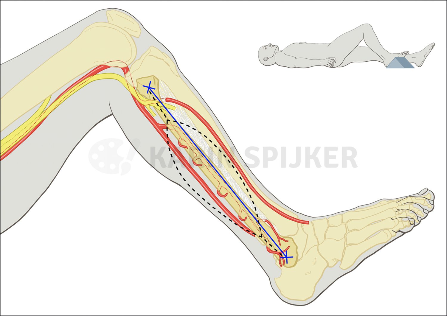 Anatomical illustration of leg vascular and nerve systems, essential for reconstructive surgery studies.