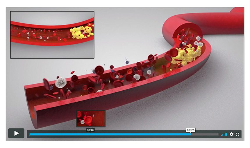 3D blood vessel visualization showcasing blood flow dynamics and cellular components in circulation.